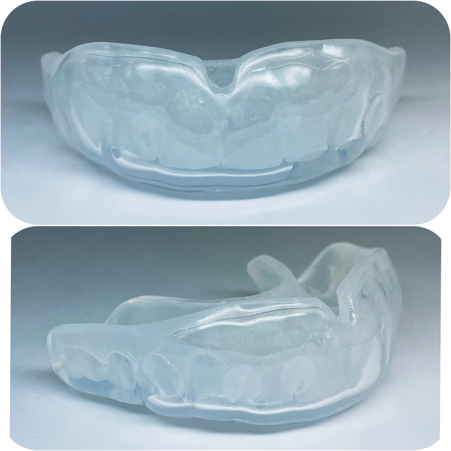 CUSTOM FIT GUMSHIELD | Choice of | Outer colour